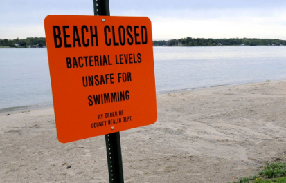 beach closed sign warning of bacteria